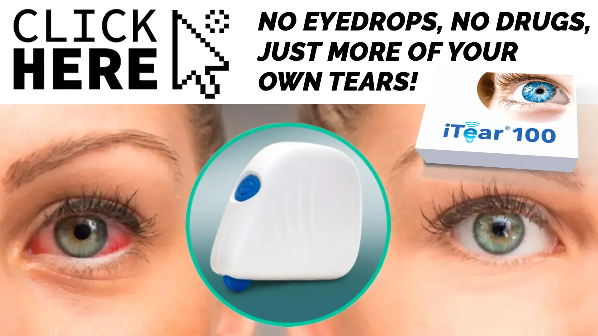 How the iTEAR100 Device Transforms Dry Eye Treatment
