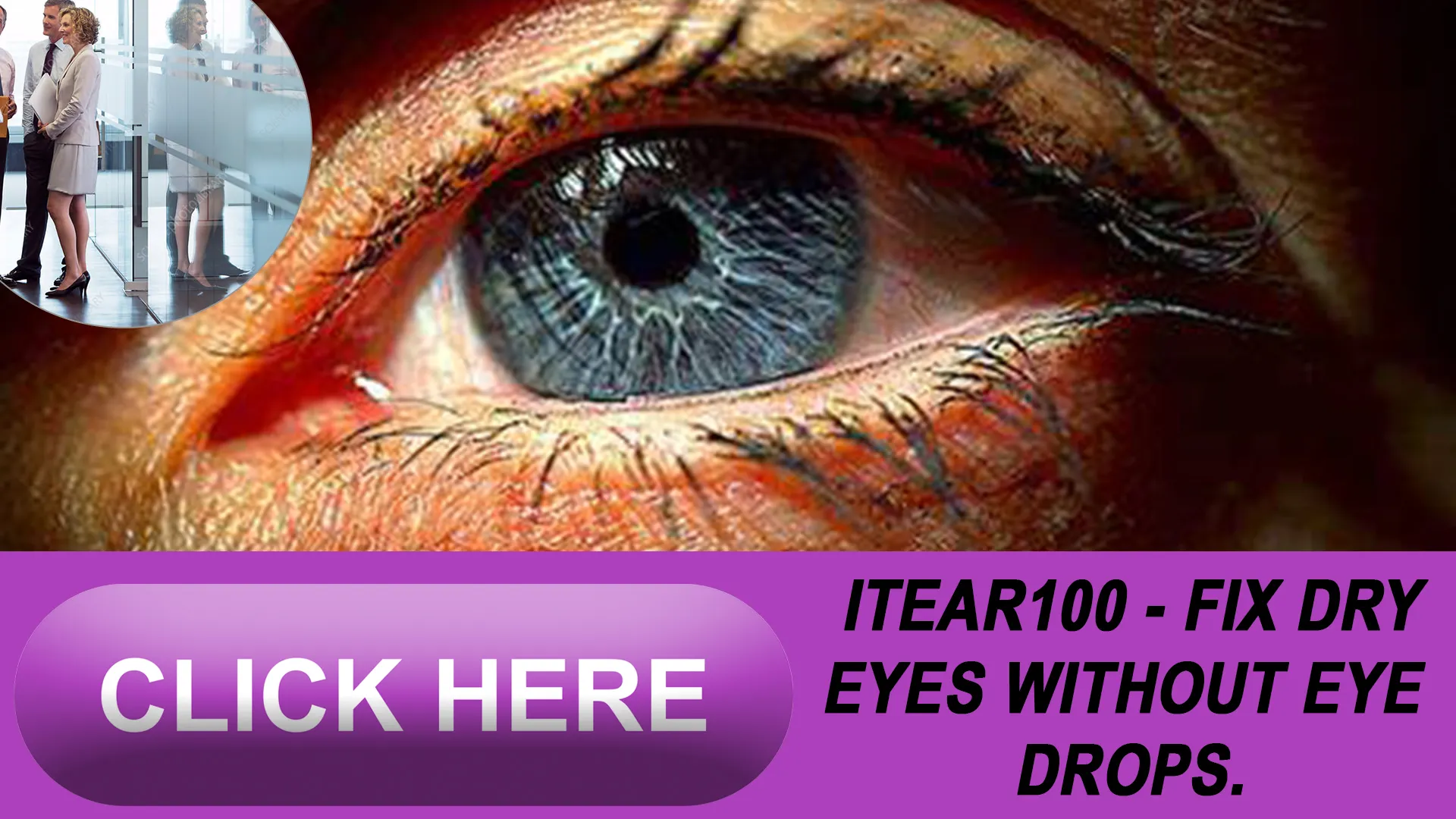 Understanding Dry Eye Syndrome and Its Impact