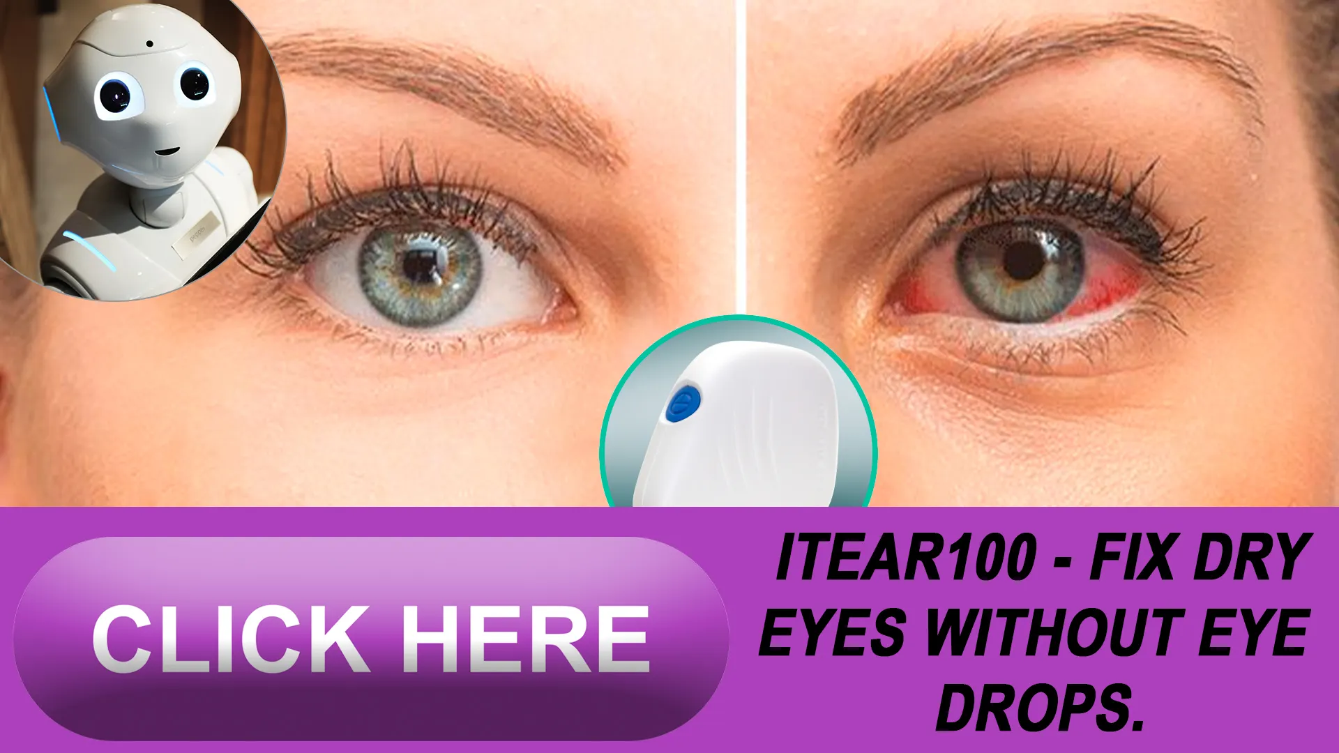Why the iTEAR100 Device is a Game-Changer for Dry Eye Management